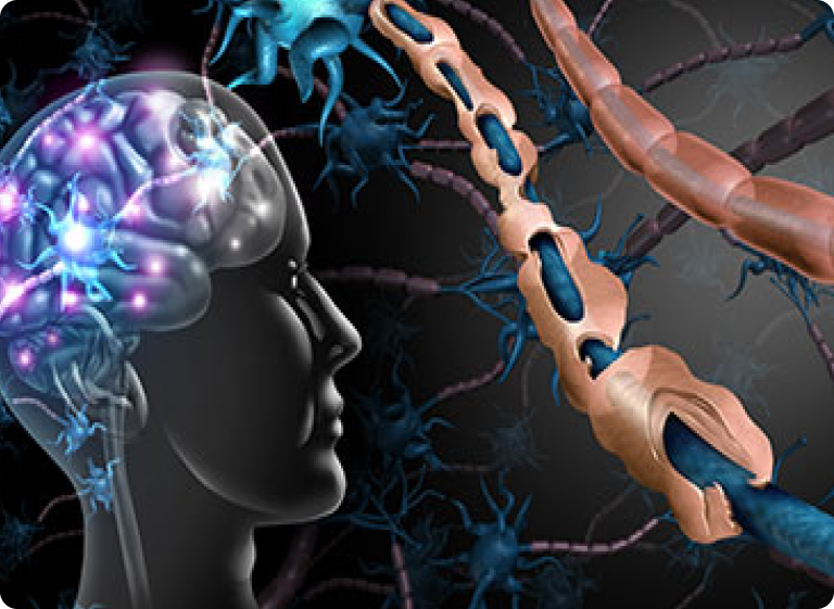 Demyelinating Diseases